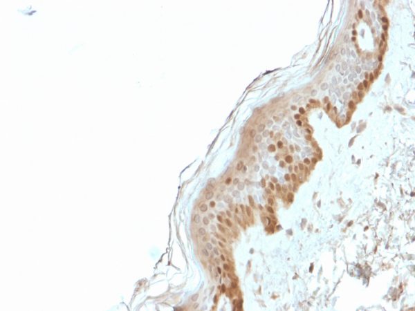Formalin-fixed, paraffin-embedded human Skin stained with S100A2 Mouse Monoclonal Antibody (CPTC-S100A2-2).