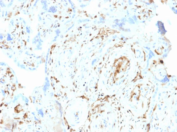 Formalin-fixed, paraffin-embedded human Placenta stained with S100A2 Mouse Monoclonal Antibody (CPTC-S100A2-2).