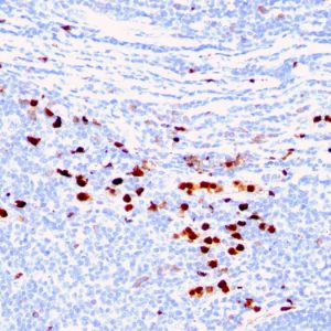 Formalin-fixed, paraffin-embedded human Tonsil stained with Macrophage L1 Protein Mouse Monoclonal Antibody (MAC387)