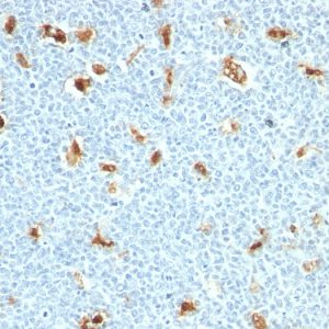 Formalin-fixed, paraffin-embedded human Tonsil stained with S100A9 Mouse Monoclonal Antibody (S100A9/1011).