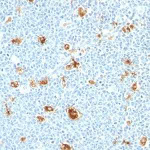 Formalin-fixed, paraffin-embedded human tonsil stained with Calgranulin B Monoclonal Antibody (CAGB/426)