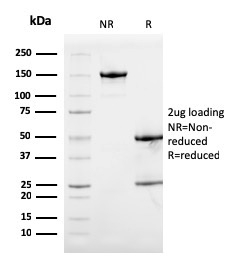 SDS-PAGE Analysis of Purified Calprotectin Mouse Monoclonal Antibody (S100A9/1075). Confirmation of Purity and Integrity of Antibody.