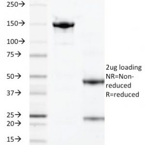 SDS-PAGE Analysis of Purified Calprotectin Monoclonal Antibody (DF3973). Confirmation of Integrity and Purity of Antibody.