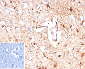 Formalin-fixed, paraffin-embedded human brain stained with S100B Mouse Monoclonal Antibody (S100B/4143) at 2ug/ml. Inset: PBS instead of primary antibody; secondary only negative control.