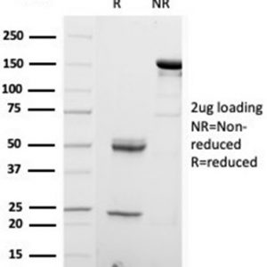 SDS-PAGE Analysis S100B Mouse Monoclonal Antibody (S100B/4153). Confirmation of Integrity and Purity of Antibody.