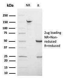SDS-PAGE Analysis of Purified S100B Mouse Monoclonal Antibody (S100B/4138). Confirmation of Purity and Integrity of Antibody.
