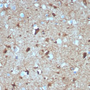 Formalin-fixed, paraffin-embedded human brain stained with S100B Mouse Monoclonal Antibody (S100B/4139).
