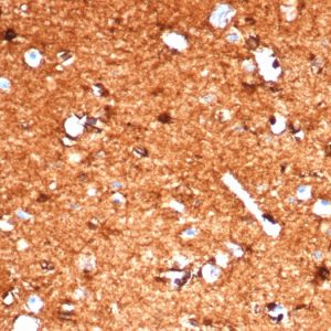 Formalin-fixed, paraffin-embedded human brain stained with S100B Recombinant Rabbit Monoclonal Antibody (S100B/1706R).