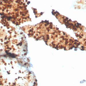 Formalin-fixed, paraffin-embedded human spleen stained with S100P Recombinant Rabbit Monoclonal Antibody (S100P/4386R).