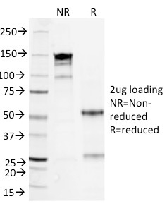 SDS-PAGE Analysis Purified Serum Amyloid A Mouse Monoclonal Antibody (SAA/326). Confirmation of Purity and Integrity of Antibody.