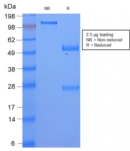 SDS-PAGE Analysis Serum Amyloid A Rabbit Recombinant Monoclonal Antibody (SAA/2868R). Confirmation of Purity and Integrity of Antibody.