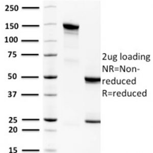 SDS-PAGE Analysis Purified Spermidine Monoclonal Antibody (CPTC-SAT1-3). Confirmation of Purity and Integrity of Antibody
