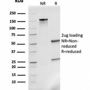 SDS-PAGE Analysis Purified MCP2 / CCL8 Mouse Monoclonal Antibody (CCL8/3311). Confirmation of Purity and Integrity of Antibody.