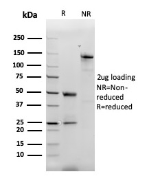 SDS-PAGE Analysis of Purified MCP2 / CCL8 Mouse Monoclonal Antibody (CCL8/3312). Confirmation of Purity and Integrity of Antibody.