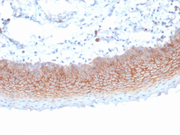 Formalin-fixed, paraffin-embedded human tonsil stained with CD138 Mouse Monoclonal Antibody (SDC1/7180). HIER: Tris/EDTA, pH9.0, 45min. 2 °: HRP-polymer, 30min. DAB, 5min.