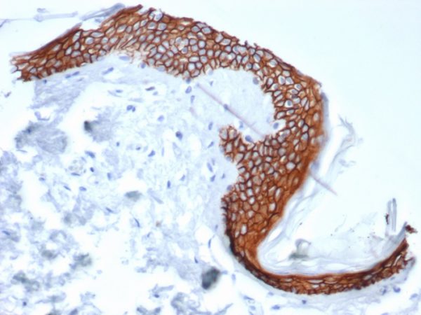 Formalin-fixed, paraffin-embedded human tonsil stained with CD138 Mouse Monoclonal Antibody (SDC1/7180).