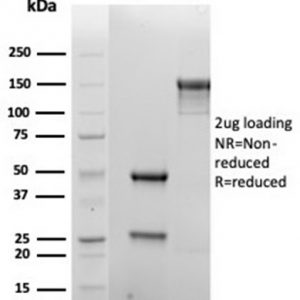 SDS-PAGE Analysis Purified CD138 Recombinant Mouse Monoclonal Antibody (rSDC1/6866). Confirmation of Purity and Integrity of Antibody.