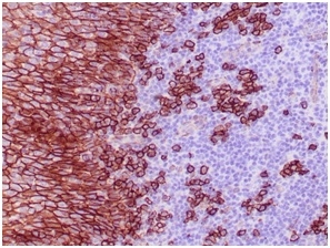 Formalin-fixed, paraffin-embedded human tonsil stained with CD138Recombinant Rabbit Monoclonal Antibody (SDC1/4378R).