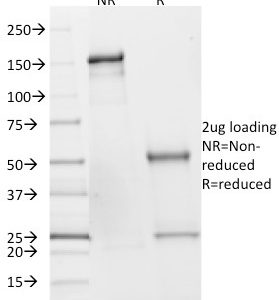 SDS-PAGE Analysis of Purified SDHB Mouse Monoclonal Antibody (SDHB/2382). Confirmation of Integrity and Purity of Antibody.