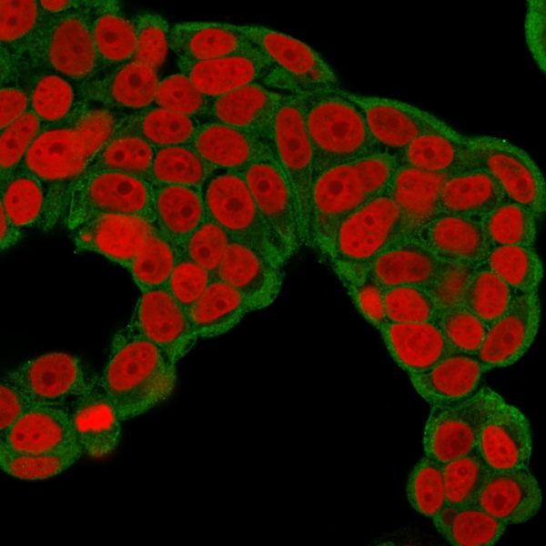 Immunofluorescence Analysis of human MCF-7 cells labeling CHP2 with CHP2 Mouse Monoclonal Antibody (CPTC-CHP2-1) followed by Goat anti-mouse IgG-CF488 (Green).The nuclear counterstain is Reddot (Red)