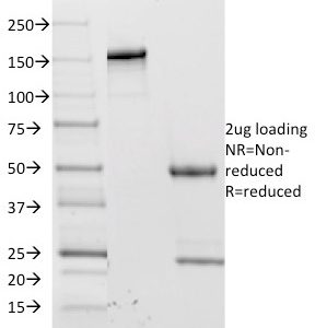 SDS-PAGE Analysis Purified CD62L Mouse Monoclonal Antibody (CD62L/1588). Confirmation of Purity and Integrity of Antibody.
