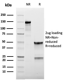 SDS-PAGE Analysis Purified CD62L Mouse Monoclonal Antibody (LAM1-116). Confirmation of Purity and Integrity of Antibody.