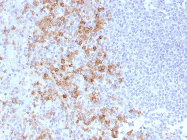 Formalin-fixed, paraffin-embedded human Spleen stained with CD162 Monoclonal Antibody (PSGL1/1601).