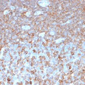 Formalin-fixed, paraffin-embedded human tonsil stained with Parvin, gamma Recombinant Rabbit Monoclonal Antibody (PARVG/6312R).
