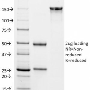 SDS-PAGE Analysis Purified Monospecific Mouse Monoclonal Antibody to VISTA (VISTA/2864). Confirmation of Integrity and Purity of Antibody.