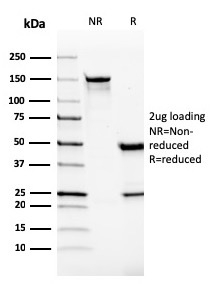 SDS-PAGE Analysis Purified Monospecific Mouse Monoclonal Antibody to VISTA (VISTA/2865). Confirmation of Integrity and Purity of Antibody.