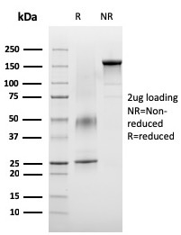 SDS-PAGE Analysis of Purified VISTA Monospecific Mouse Monoclonal Antibody (VISTA/3007). Confirmation of Integrity and Purity of Antibody.