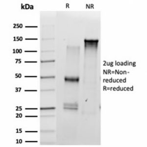 SDS-PAGE Analysis of Purified SCXA Mouse Monoclonal Antibody (PCRP-SCXA-1D2). Confirmation of Purity and Integrity of Antibody.