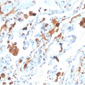 Formalin-fixed, paraffin-embedded human lung stained with Surfactant Protein D Mouse Monoclonal Antibody (SFTPD/4363).