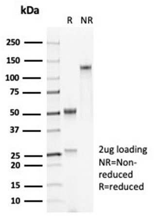 SDS-PAGE Analysis Purified SFTPDRecombinant Rabbit Monoclonal Antibody (SFTPD/7084R). Confirmation of Purity and Integrity of Antibody.