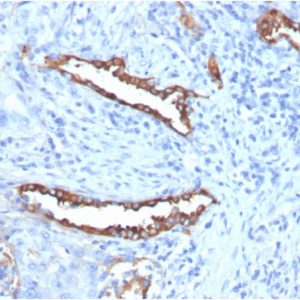 Formalin-fixed, paraffin-embedded human lung stained with Surfactant Protein DRecombinant Rabbit Monoclonal (SFTPD/7085R).