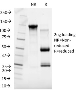 SDS-PAGE Analysis of Purified SHBG Mouse Monoclonal Antibody (SHBG/245). Confirmation of Integrity and Purity of Antibody.