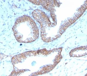 Formalin-fixed, paraffin-embedded human prostate stained with SHBG Recombinant Mouse Monoclonal Antibody (rSHBG-245). HIER: Tris/EDTA, pH9.0, 45min. 2 °: HRP-polymer, 30min. DAB, 5min.