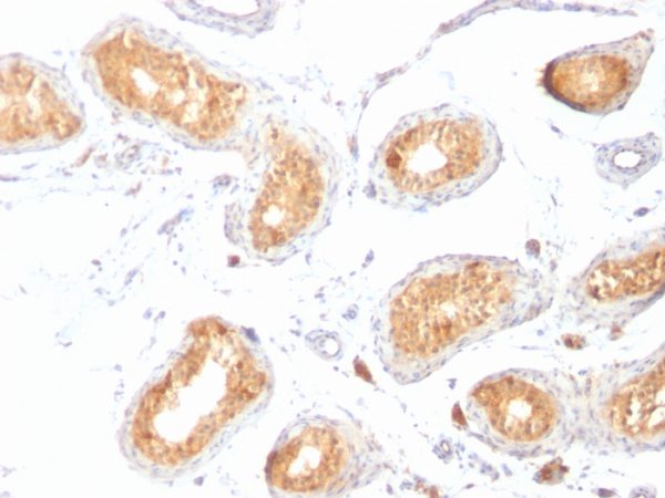 Formalin-fixed, paraffin-embedded human Testis stained with gp100 / Melanosome Monoclonal Antibody (HMB45).