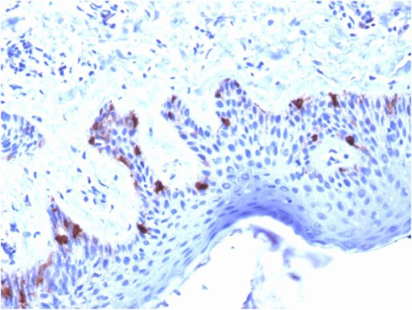Formalin-fixed, paraffin-embedded human Skin stained with gp100 Mouse Monoclonal Antibody (PMEL/2039).
