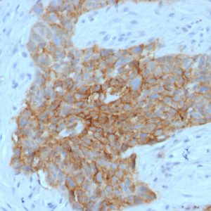 Formalin-fixed, paraffin-embedded human Tongue stained with GLUT-1 Mouse Monoclonal Antibody (GLUT1/2475).