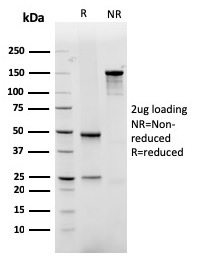 SDS-PAGE Analysis of Purified GLUT-1 Recombinant Mouse Monoclonal Antibody (rGLUT1/2476). Confirmation of Purity and Integrity of Antibody.