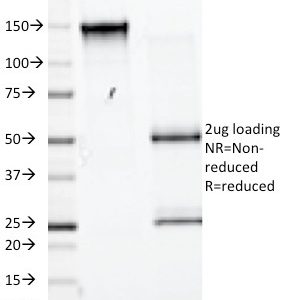 SDS-PAGE Analysis of Purified CD98 Mouse Monoclonal Antibody (UM7F8). Confirmation of Purity and Integrity of Antibody.