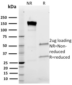 SDS-PAGE Analysis of Purified Band III Mouse Monoclonal Antibody (Q1/156). Confirmation of Purity and Integrity of Antibody.