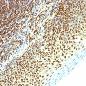 Formalin-fixed, paraffin-embedded human Tonsil stained with SUMO-2 Mouse Monoclonal Antibody (SPM261).