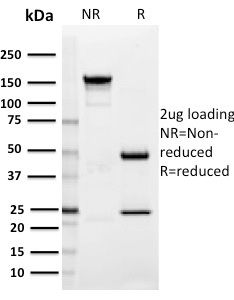 SDS-PAGE Analysis of Purified SIGLEC1 / CD169 Mouse Monoclonal Antibody (HSn 7D2). Confirmation of Integrity and Purity of Antibody.