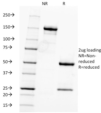 SDS-PAGE Analysis Purified Fascin-1 Mouse Monoclonal Antibody (FSCN1/416). Confirmation of Integrity and Purity of Antibody. Fascin-1 (Reed-Sternberg Cell Marker) Antibody - Image 2