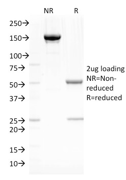 SDS-PAGE Analysis of Purified Fascin-1 Mouse Monoclonal Antibody (SPM133). Confirmation of Integrity and Purity of Antibody. Fascin-1 (Reed-Sternberg Cell Marker) Antibody - Image 3