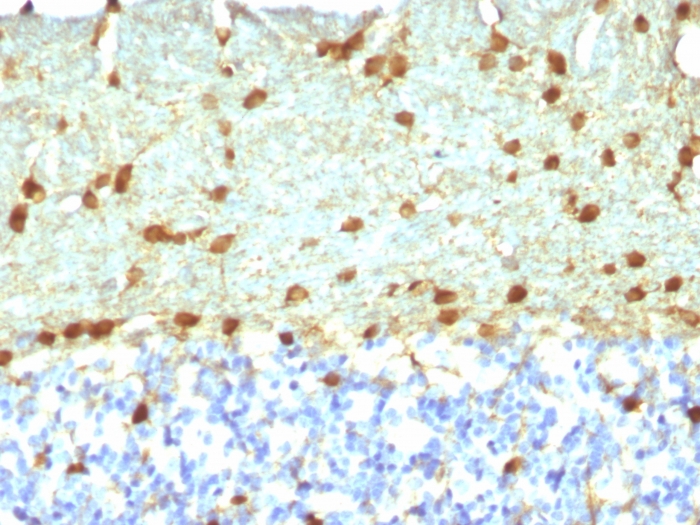 Formalin-fixed, paraffin-embedded Rat Brain stained with Fascin-1 Mouse Monoclonal Antibody (FSCN1/418). Fascin-1 (Reed-Sternberg Cell Marker) Antibody - Image 2