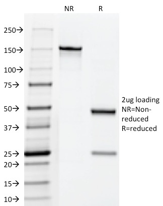 SDS-PAGE Analysis Purified Fascin-1 Mouse Monoclonal Antibody (FSCN1/418). Confirmation of Integrity and Purity of Antibody. Fascin-1 (Reed-Sternberg Cell Marker) Antibody - Image 3