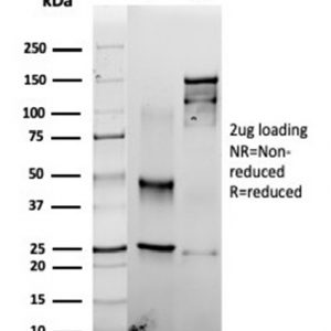 SDS-PAGE Analysis of Purified Fascin-1 Recombinant Mouse Monoclonal Antibody (rFSCN1/6464). Confirmation of Integrity and Purity of Antibody.